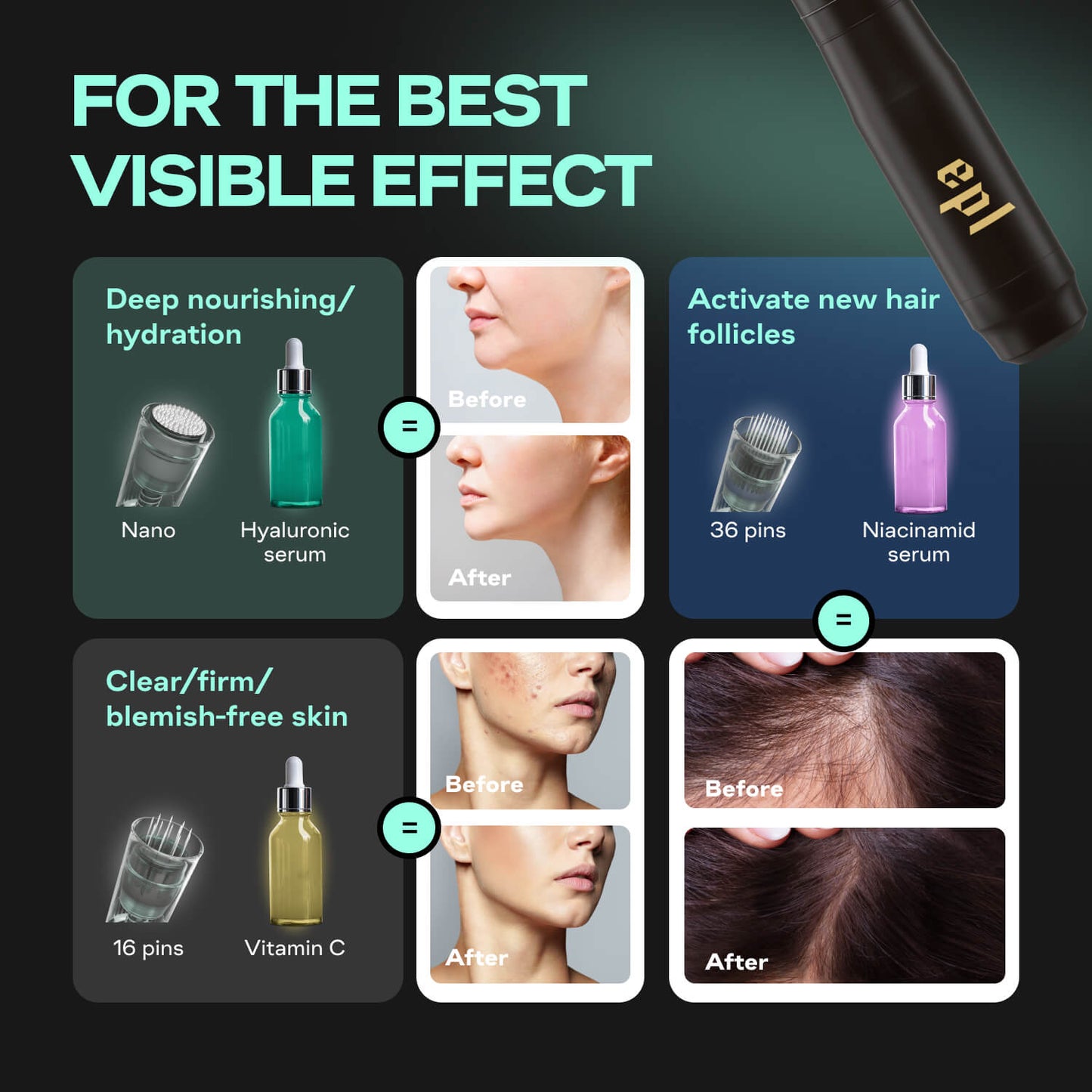 Microneedling Pen M8 | Including 7 36-pin, 7 16-pin and 2 nano needles