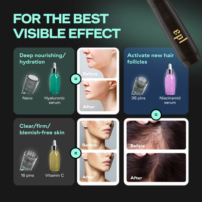 Microneedling Pen M8 | Including 7 36-pin, 7 16-pin and 2 nano needles