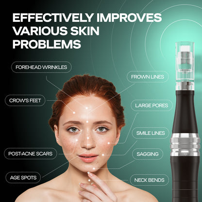 Microneedling Pen M8 | Including 7 36-pin, 7 16-pin and 2 nano needles